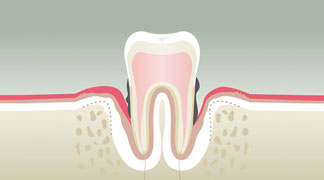 Parodontologie & Hygiène à Ares